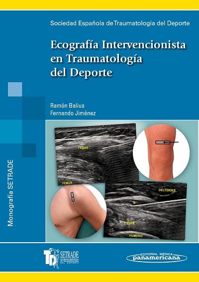 ECOGRAFÍA INTERVENCIONISTA EN TRAUMATOLOGÍA DEL DEPORTE | 9788498353617 | SETRADE SOCIEDAD ESPAÑOLA DE TRAUMATOLOGÍA DEL DEPORTE | Llibres Parcir | Llibreria Parcir | Llibreria online de Manresa | Comprar llibres en català i castellà online