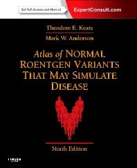 ATLAS OF NORMAL ROENTGEN VARIANTS THAT MAY SIMULATE DISEASE | 9780323073554 | KEATS, THEODORE E. | Llibres Parcir | Llibreria Parcir | Llibreria online de Manresa | Comprar llibres en català i castellà online