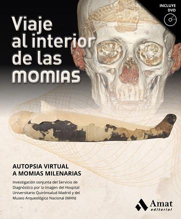 VIAJE AL INTERIOR DE LAS MOMIAS | 9788417208769 | SERVICIO DE DIAGNÓSTICO POR LA IMAGEN DEL HOSPITAL UNIVERSITARIO QUIRÓNSALUD MADRID/MUSEO ARQUEOLÓGI | Llibres Parcir | Llibreria Parcir | Llibreria online de Manresa | Comprar llibres en català i castellà online