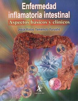 ENFERMEDAD INFLAMATORIA INTESTINAL. ASPECTOS BÁSICOS Y CLÍNICOS | PODI72978 | YAMAMOTO FURUSHO  JESÚS KAZUO | Llibres Parcir | Llibreria Parcir | Llibreria online de Manresa | Comprar llibres en català i castellà online