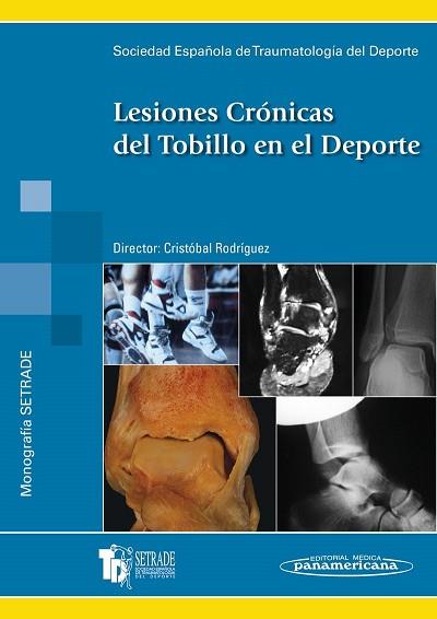 LESIONES CRÓNICAS DEL TOBILLO EN EL DEPORTE | 9788479037925 | RODRÍGUEZ HERNÁNDEZ, CRISTÓBAL | Llibres Parcir | Llibreria Parcir | Llibreria online de Manresa | Comprar llibres en català i castellà online