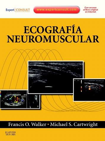 ECOGRAFÍA NEUROMUSCULAR + EXPERTCONSULT | 9788480869393 | WALKER, FRANCIS O./CARTWRIGHT, MICHAEL S. | Llibres Parcir | Llibreria Parcir | Llibreria online de Manresa | Comprar llibres en català i castellà online